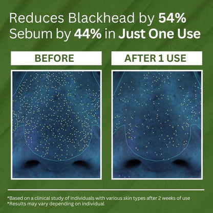 K-Beauty Bubble Mask