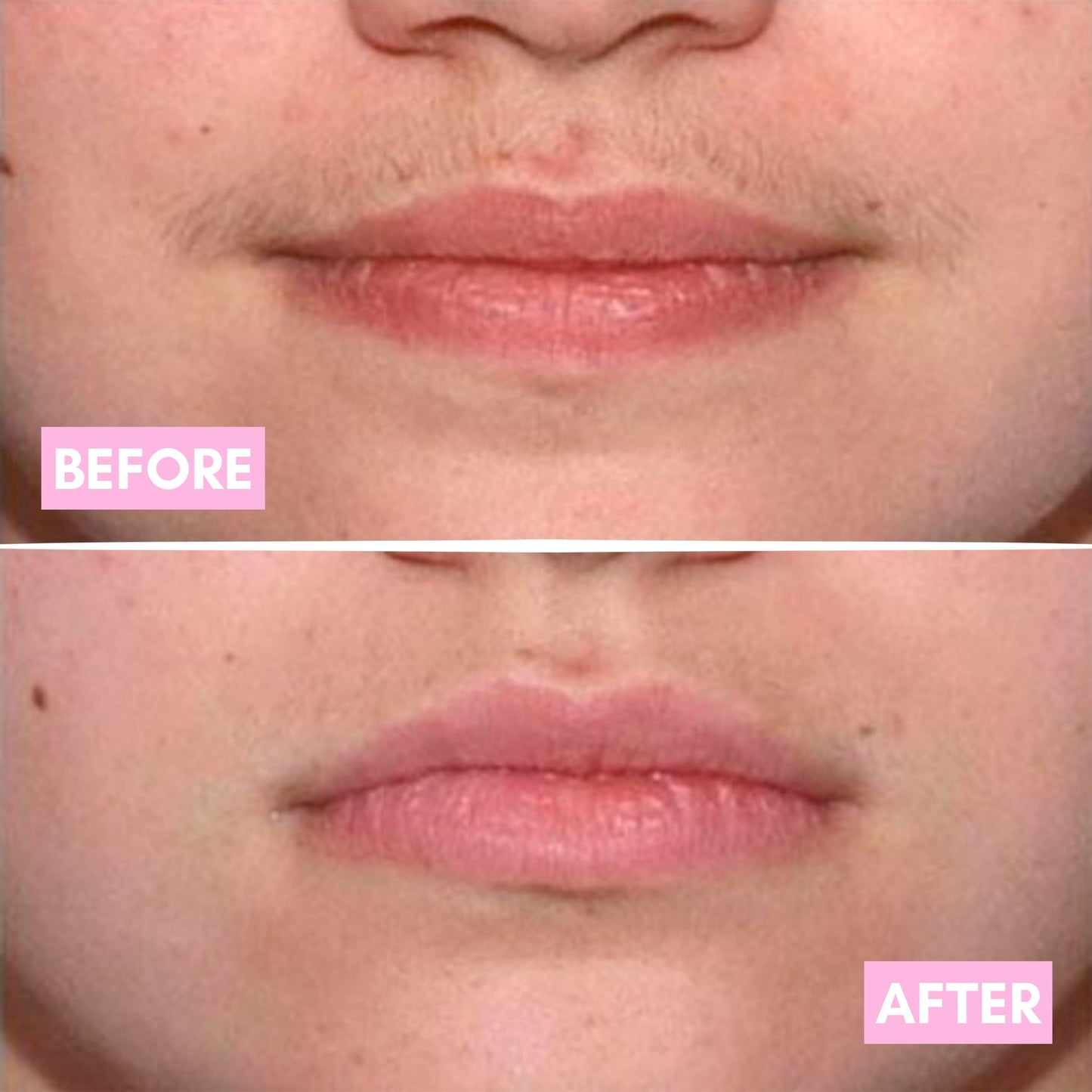 Smoother Looking Skin. SlowerAppearing Hair Regrowth - SmoothRoot Oil™