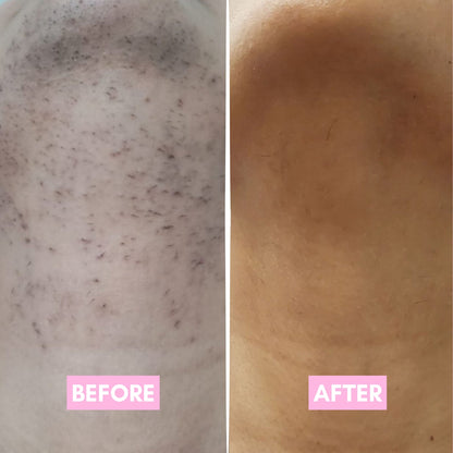 Smoother Looking Skin. SlowerAppearing Hair Regrowth - SmoothRoot Oil™