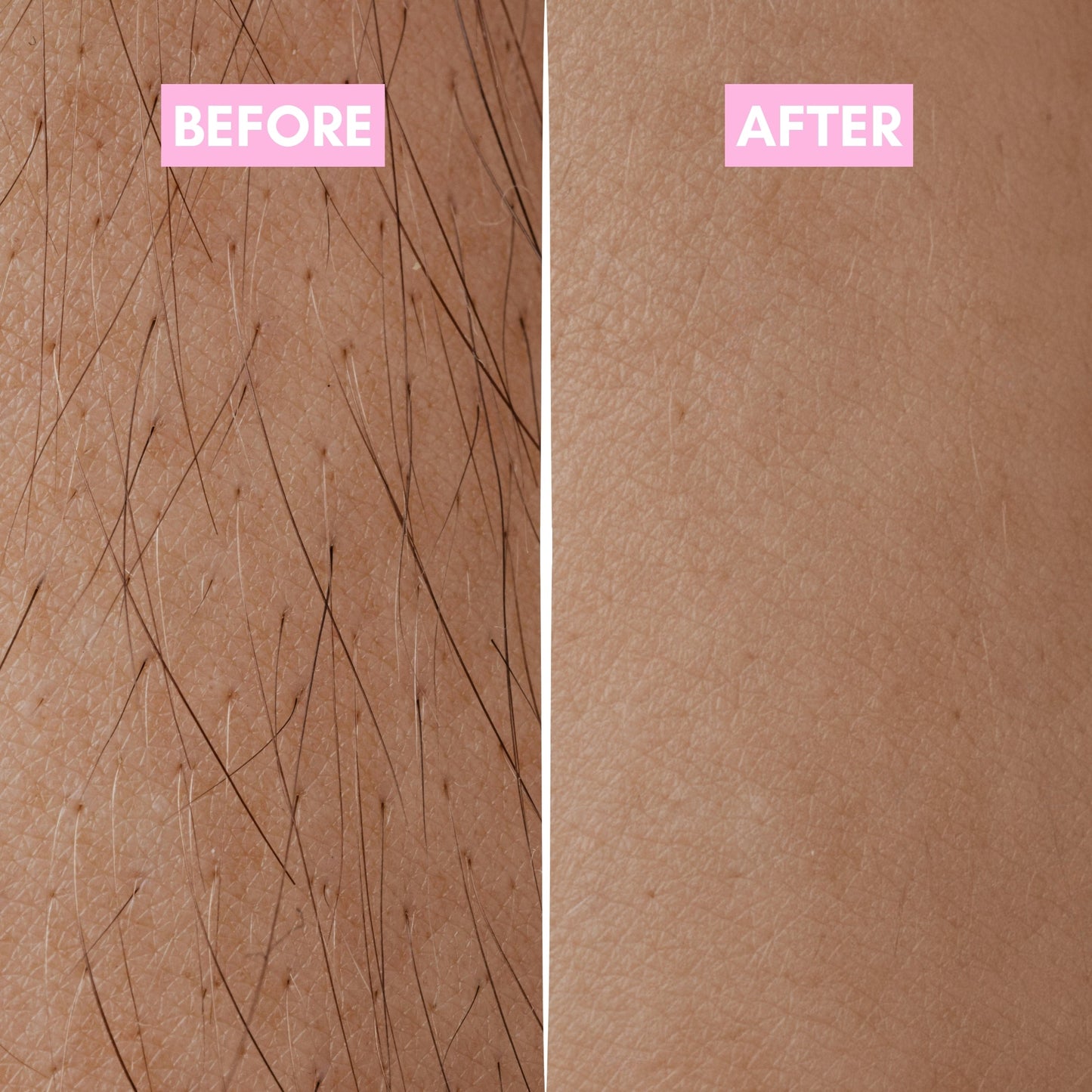 Smoother Looking Skin. SlowerAppearing Hair Regrowth - SmoothRoot Oil™