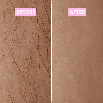 Smoother Looking Skin. SlowerAppearing Hair Regrowth - SmoothRoot Oil™